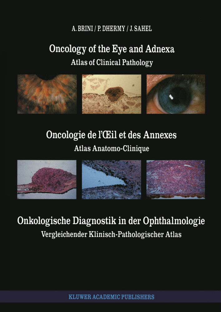 Oncology of the Eye and Adnexa / Oncologie de l'OEil et des Annexes / Onkologische Diagnostik in der Ophthalmologie von Springer Netherlands