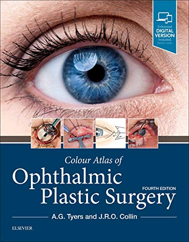 Colour Atlas of Ophthalmic Plastic Surgery von Elsevier