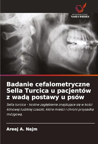 Badanie cefalometryczne Sella Turcica u pacjentów z wad¿ postawy u psów: Sella turcica - kostne zag¿¿bienie znajduj¿ce si¿ w ko¿ci klinowej ludzkiej czaszki, które mie¿ci i chroni przysadk¿ mózgow¿. von Wydawnictwo Nasza Wiedza
