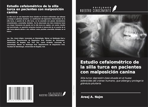 Estudio cefalométrico de la silla turca en pacientes con malposición canina: Silla turca: depresión ósea situada en el hueso esfenoides del cráneo humano, que alberga y protege la glándula pituitaria. von Ediciones Nuestro Conocimiento