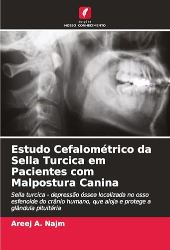 Estudo Cefalométrico da Sella Turcica em Pacientes com Malpostura Canina: Sella turcica - depressão óssea localizada no osso esfenoide do crânio humano, que aloja e protege a glândula pituitária von Edições Nosso Conhecimento