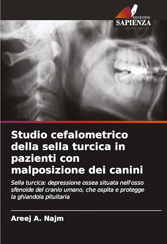 Studio cefalometrico della sella turcica in pazienti con malposizione dei canini: Sella turcica: depressione ossea situata nell'osso sfenoide del ... che ospita e protegge la ghiandola pituitaria von Edizioni Sapienza