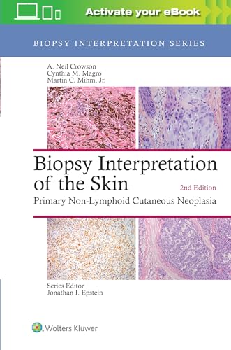 Biopsy Interpretation of the Skin: Primary Non-Lymphoid Cutaneous Neoplasia (Biopsy Interpretation Series) von LWW