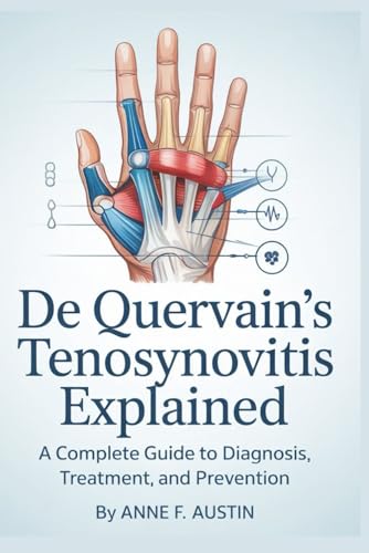 De Quervain’s Tenosynovitis Explained: A Complete Guide to Diagnosis, Treatment, and Prevention von Independently published