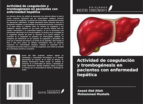 Actividad de coagulación y trombogénesis en pacientes con enfermedad hepática