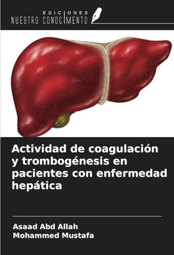 Actividad de coagulación y trombogénesis en pacientes con enfermedad hepática