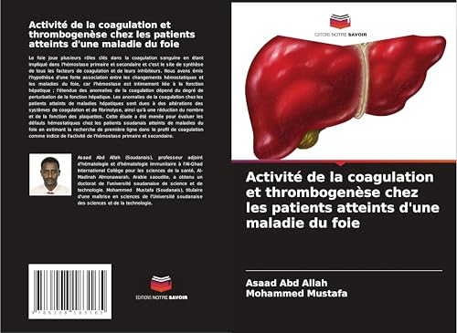 Activité de la coagulation et thrombogenèse chez les patients atteints d'une maladie du foie