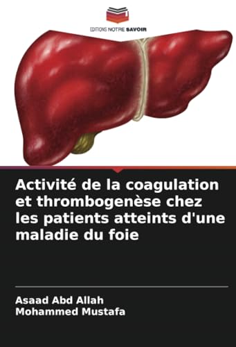 Activité de la coagulation et thrombogenèse chez les patients atteints d'une maladie du foie Activité de la coagulation et thrombogenèse chez les patients atteints d'une maladie du foie