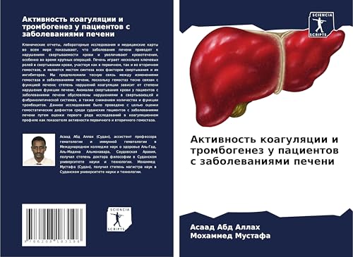 Aktiwnost' koagulqcii i trombogenez u pacientow s zabolewaniqmi pecheni: DE