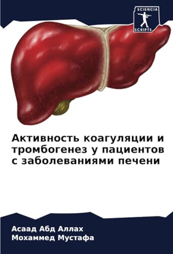 Активность коагуляции и тромбогенез у пациентов с заболеваниями печени: DE