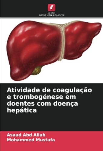 Atividade de coagulação e trombogénese em doentes com doença hepática von Edições Nosso Conhecimento