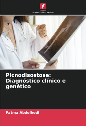 Picnodisostose: Diagnóstico clínico e genético: DE von Edições Nosso Conhecimento