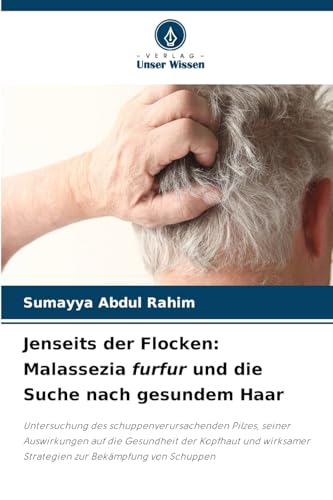 Jenseits der Flocken: Malassezia furfur und die Suche nach gesundem Haar: Untersuchung des schuppenverursachenden Pilzes, seiner Auswirkungen auf die ... Strategien zur Bekämpfung von Schuppen von Verlag Unser Wissen
