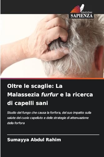 Oltre le scaglie: La Malassezia furfur e la ricerca di capelli sani: Studio del fungo che causa la forfora, del suo impatto sulla salute del cuoio ... delle strategie di attenuazione della forfora von Edizioni Sapienza