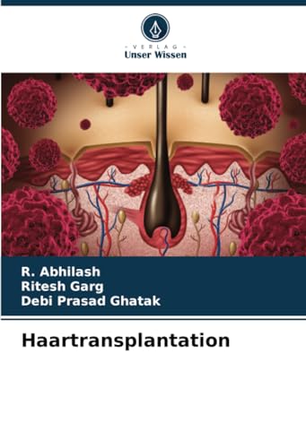 Haartransplantation: DE