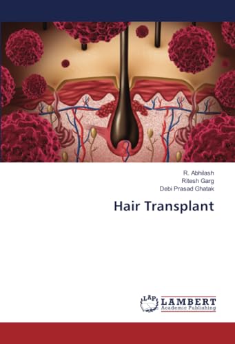 Hair Transplant von LAP LAMBERT Academic Publishing