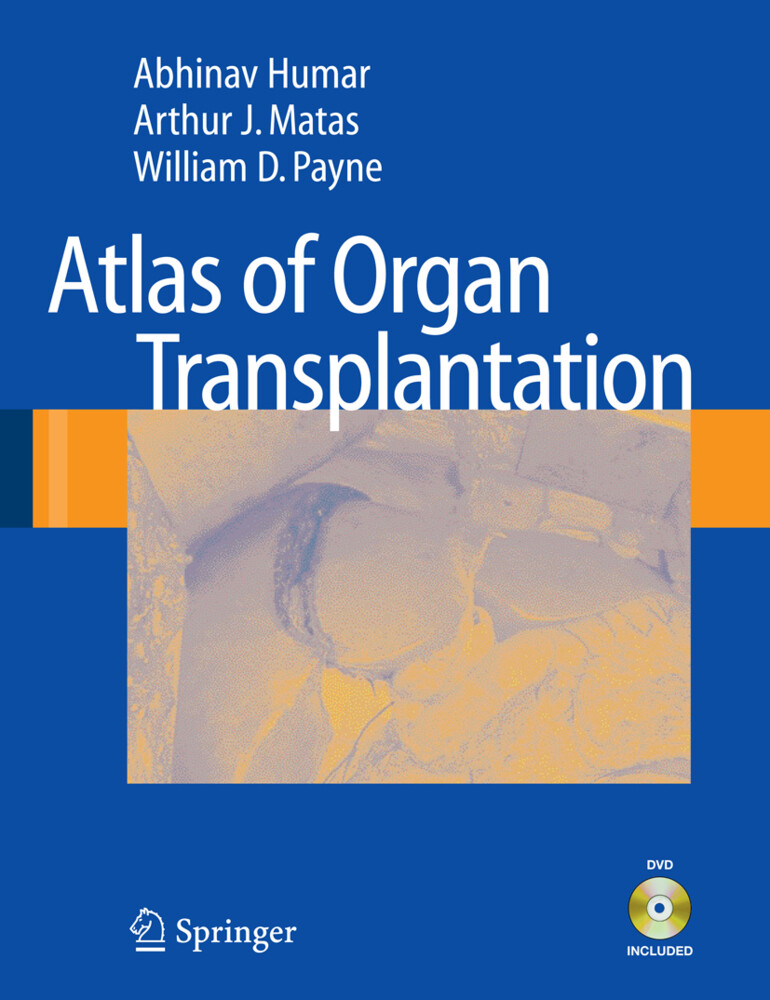 Atlas of Organ Transplantation von Springer London