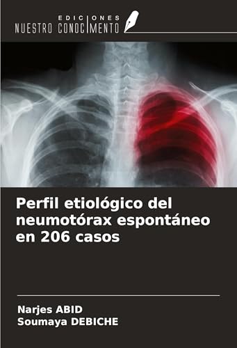 Perfil etiológico del neumotórax espontáneo en 206 casos