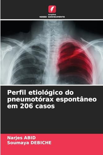 Perfil etiológico do pneumotórax espontâneo em 206 casos: DE von Edições Nosso Conhecimento