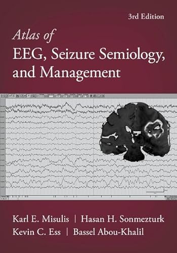 Atlas of EEG, Seizure Semiology, and Management von Oxford University Press Inc