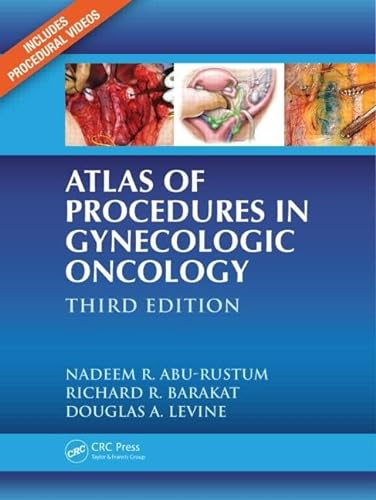 Atlas of Procedures in Gynecologic Oncology von CRC Press