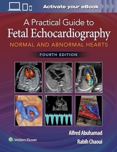 A Practical Guide to Fetal Echocardiography: Normal and Abnormal Hearts von Lippincott Williams&Wilki