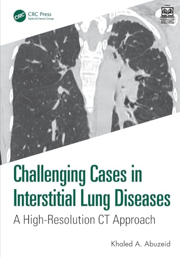 Challenging Cases in Interstitial Lung Diseases: A High-resolution Ct Approach von CRC Press