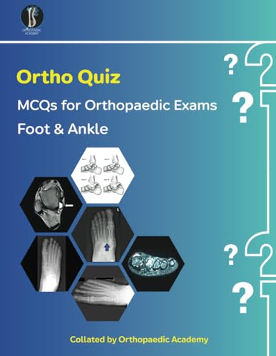 Ortho Quiz: Foot & Ankle (Concise Orthopaedics) von Independently published
