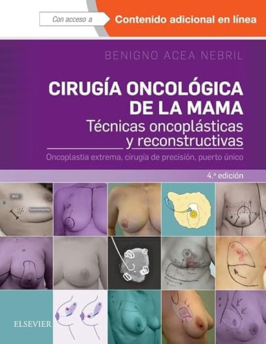 CIRUGÍA ONCOLÓGICA DE LA MAMA.4ª ED.: Técnicas oncoplásticas y reconstructivas. Oncoplastia extrema, cirugía de precisión, puerto único von Elsevier