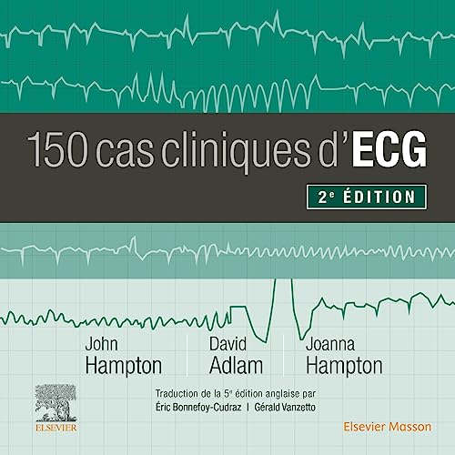 150 cas cliniques d'ECG von Elsevier Masson