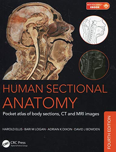 Human Sectional Anatomy: Pocket Atlas of Body Sections, CT and MRI Images