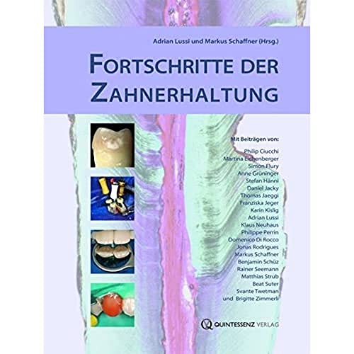 Fortschritte der Zahnerhaltung