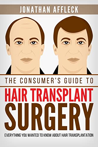 The Consumer's Guide to Hair Transplant Surgery: Everything You Wanted to Know About Hair Transplantation von CREATESPACE
