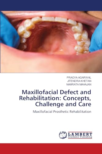 Maxillofacial Defect and Rehabilitation: Concepts, Challenge and Care: Maxillofacial Prosthetic Rehabilitation von LAP LAMBERT Academic Publishing