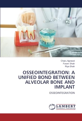 OSSEOINTEGRATION: A UNIFIED BOND BETWEEN ALVEOLAR BONE AND IMPLANT: OSSEOINTEGRATION von LAP LAMBERT Academic Publishing