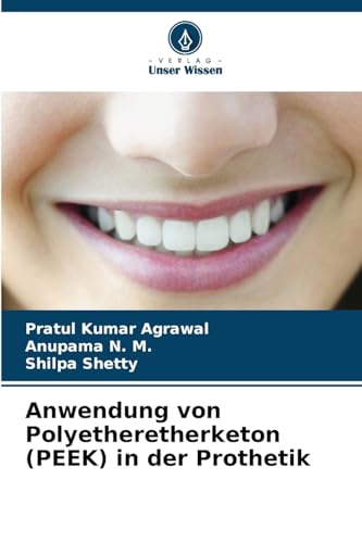 Anwendung von Polyetheretherketon (PEEK) in der Prothetik von Verlag Unser Wissen