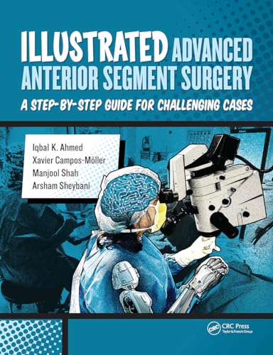 Illustrated Advanced Anterior Segment Surgery: A Step-by-Step Guide for Challenging Cases von CRC Press