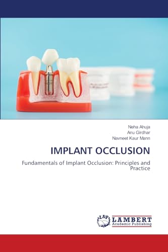 IMPLANT OCCLUSION: Fundamentals of Implant Occlusion: Principles and Practice von LAP LAMBERT Academic Publishing