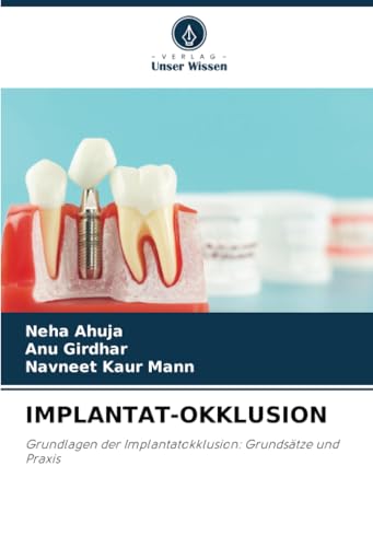 IMPLANTAT-OKKLUSION: Grundlagen der Implantatokklusion: Grundsätze und Praxis
