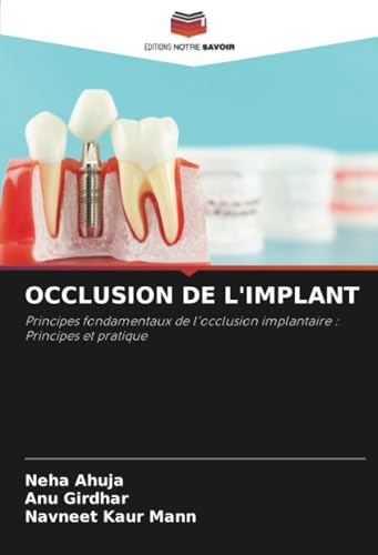 OCCLUSION DE L'IMPLANT: Principes fondamentaux de l'occlusion implantaire : Principes et pratique von Editions Notre Savoir