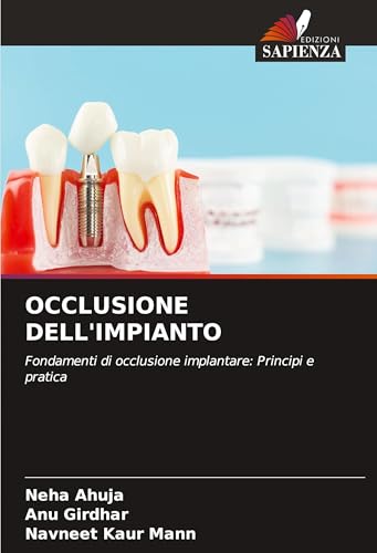 OCCLUSIONE DELL'IMPIANTO: Fondamenti di occlusione implantare: Principi e pratica von Edizioni Sapienza