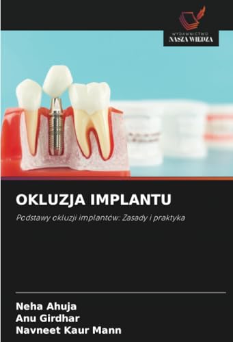 OKLUZJA IMPLANTU: Podstawy okluzji implantów: Zasady i praktyka von Wydawnictwo Nasza Wiedza