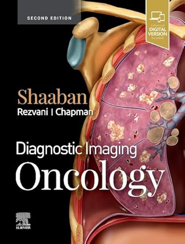 Diagnostic Imaging: Oncology von Elsevier