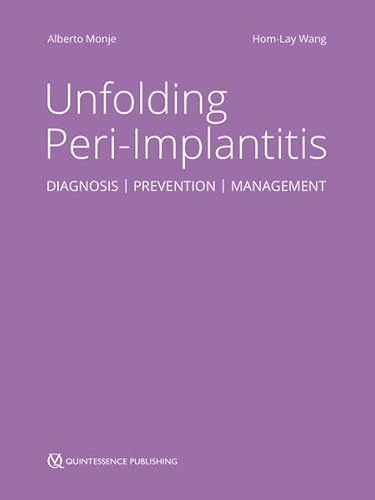 Unfolding Peri-Implantitis: Diagnosis | Prevention | Management von Quintessence Publishing