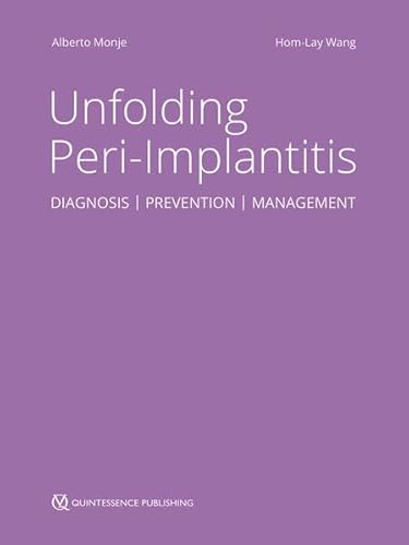 Unfolding Peri-Implantitis: Diagnosis | Prevention | Management Unfolding Peri-Implantitis: Diagnosis | Prevention | Management von Quintessence Publishing