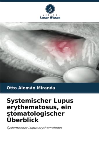Systemischer Lupus erythematosus, ein stomatologischer Überblick: Systemischer Lupus erythematodes von Verlag Unser Wissen