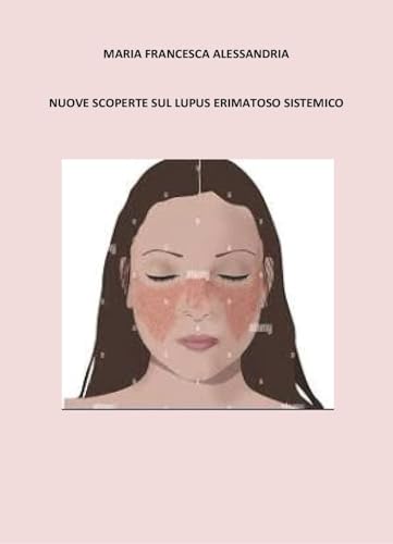 Nuove scoperte sul lupus erimatoso sistemico von Youcanprint