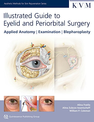 Illustrated Guide to Eyelid and Periorbital Surgery: Applied Anatomy | Examination | Blepharoplasty (Aesthetic Methods for Skin Rejuvenation Series)
