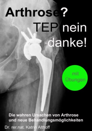 Arthrose? TEP nein danke!: Die wahren Ursachen von Arthrose und neue Behandlungsmöglichkeiten von 978-3-910834
