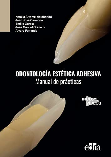Odontología estética adhesiva. Manual de prácticas von ESTERI